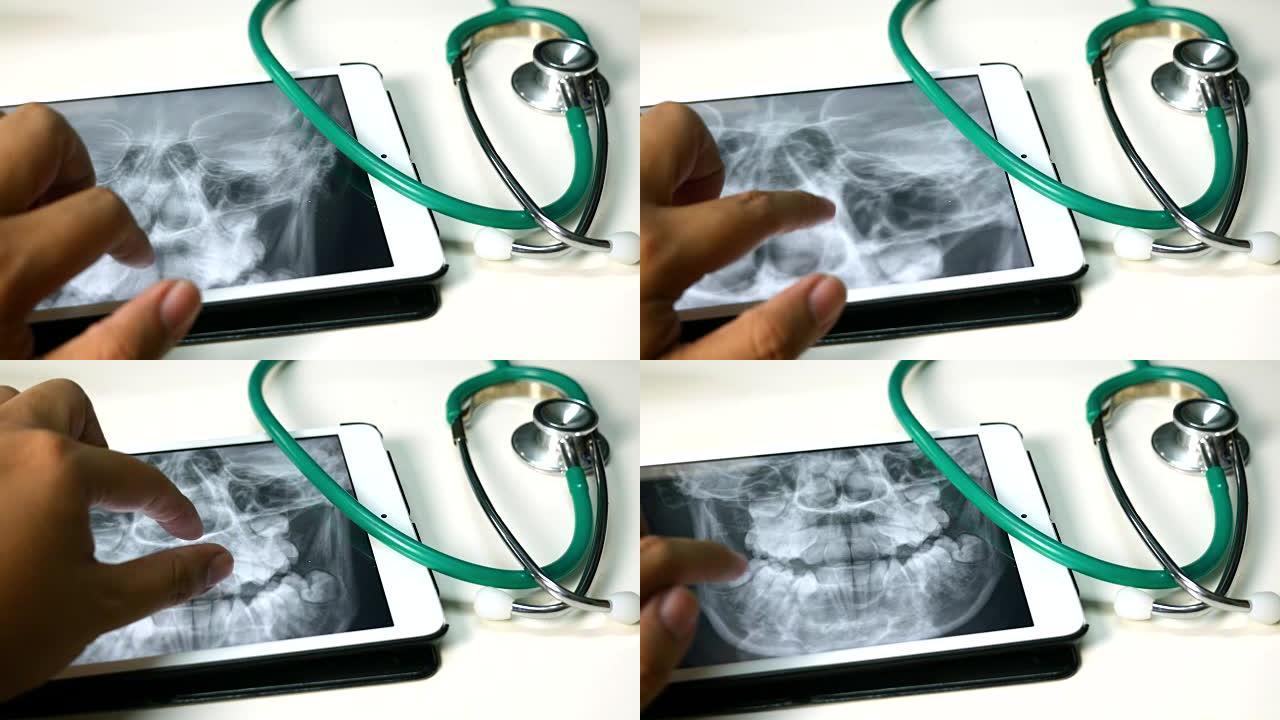 医生检查平板电脑上的颅骨x射线MRI图像，医疗保健和医学概念
