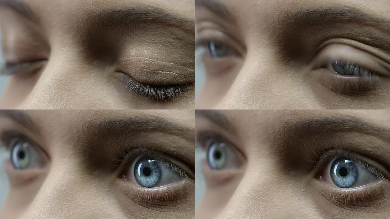 人眼角膜检查睁眼