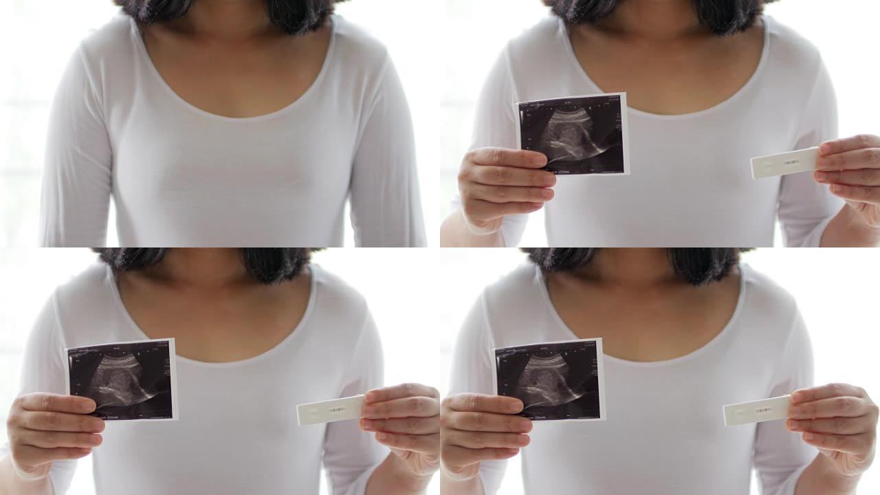 孕妇进行妊娠试验和超声扫描
