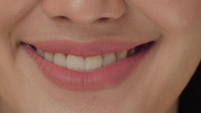 微笑的女人嘴巴长着洁白的牙齿。