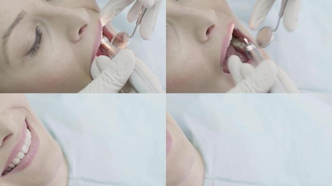 牙医的年轻女子牙科医生牙齿整形牙齿填补