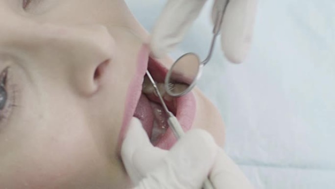 牙医的年轻女子口腔特写医治医牙
