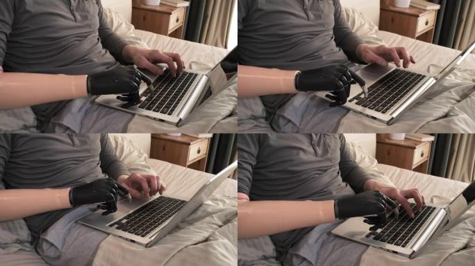 患有仿生假肢的残疾人在床上的笔记本电脑上工作