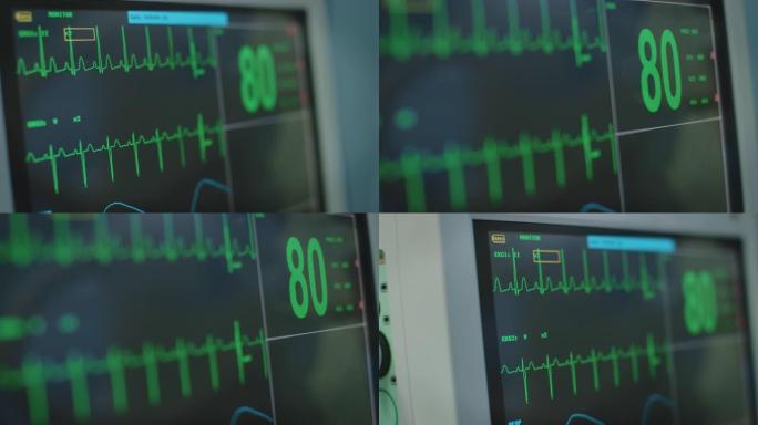 医院监测系统中的脉搏痕迹