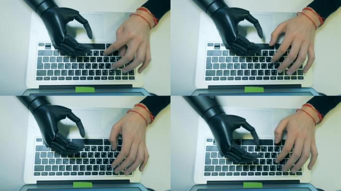 假肢和健康的手在键盘上打字。未来派的人类半机械人概念。