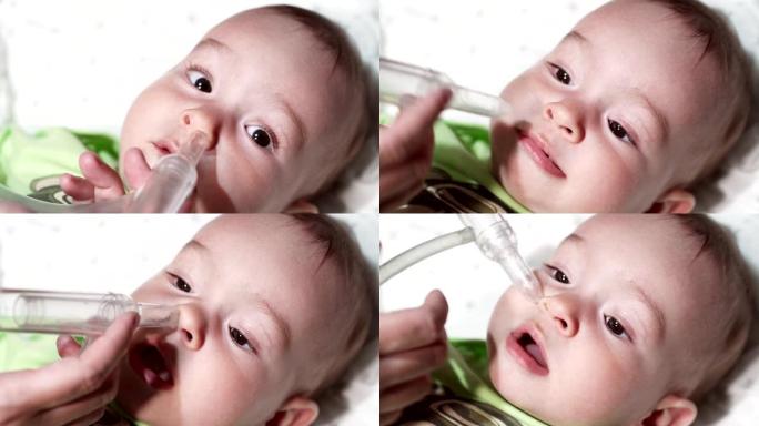 用吸气器清洁婴儿的鼻子