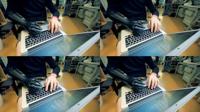 一名假肢男子正在键盘上打字