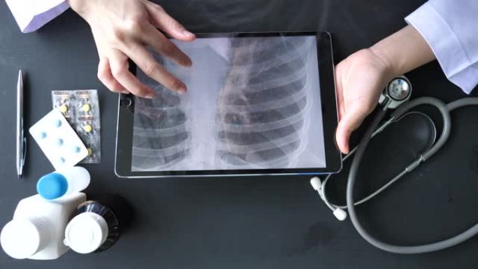 数字平板电脑肺x线图像的医生分析