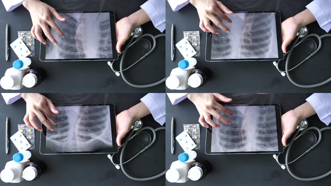 数字平板电脑肺x线图像的医生分析