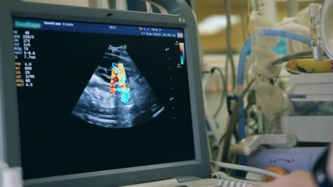 工作医生用超声波检查婴儿。