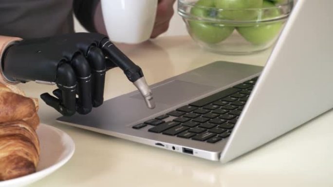 无法识别的截肢者，在笔记本电脑上进行仿生手腕打字