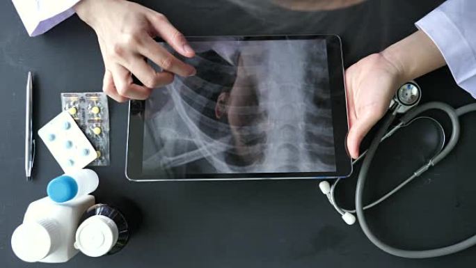 医生分析平板电脑上的x射线图像