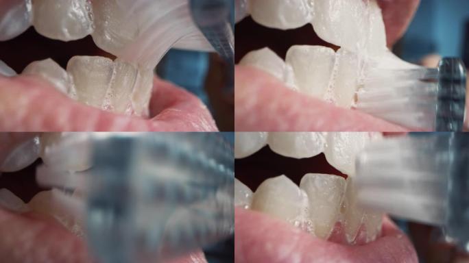 刷白牙的人的极端近距离微距拍摄。美白牙膏用于手动牙刷，该牙刷以水平和圆形方式移动。自然的嘴与完美的白