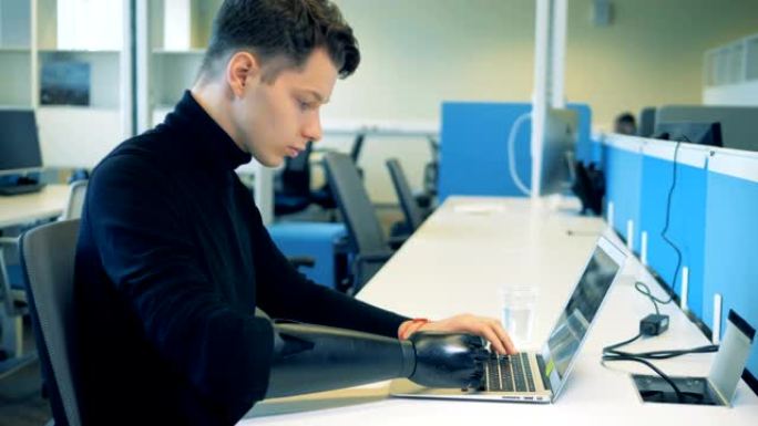 一名男子坐在桌子旁，戴着假手用笔记本电脑工作。4K。