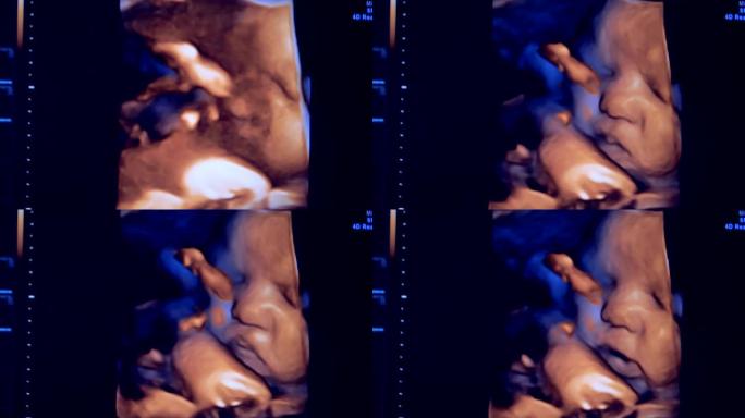 婴儿超声波图像的特写。子宫中未出生的真实形象。