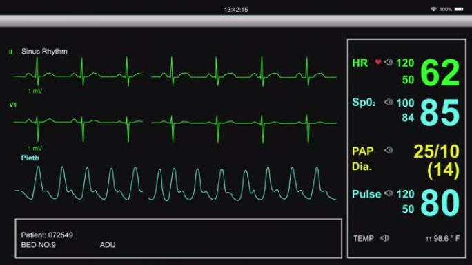 EKG病人心脏监护仪医院设备