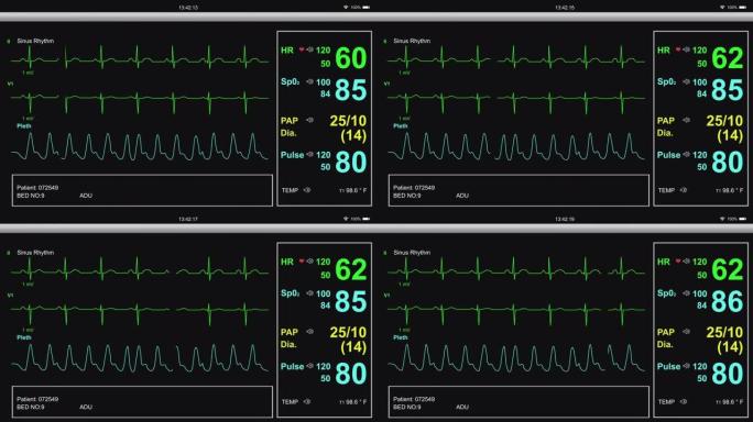 EKG病人心脏监护仪医院设备
