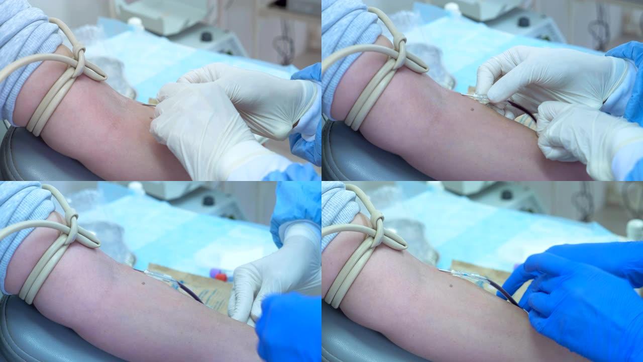 医生将一根针放在病人的手臂上取血，捐献中心。