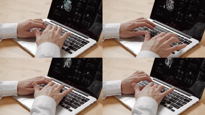 医生分析笔记本电脑上医疗扫描仪的数据。