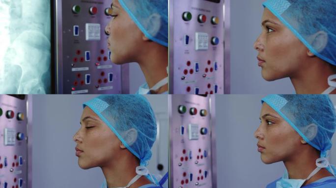 非裔美国女医生在医院看灯箱x光报告的特写