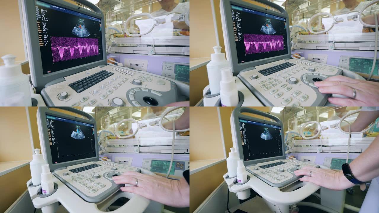 儿科医生使用超声检查机检查保育箱中的婴儿。