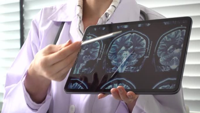 女医生显示脑部MRI扫描向患者指出数字平板电脑上的扫描细节