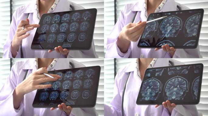 女医生显示脑部MRI扫描向患者指出数字平板电脑上的扫描细节