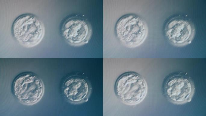 受精卵细胞正在显微镜下分析
