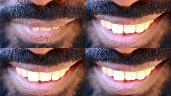 一个微笑的黑人的嘴和牙齿的特写