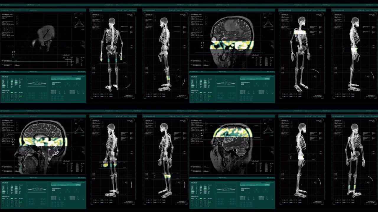 带有身体分析和dna在黑暗背景上移动的用户界面HUD动画，用于处理谷物的网络未来概念