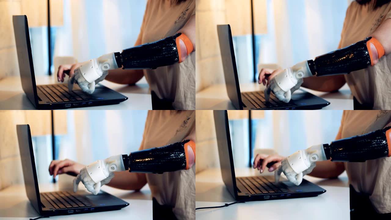 一位女士正在用健康的机械臂在笔记本电脑上打字