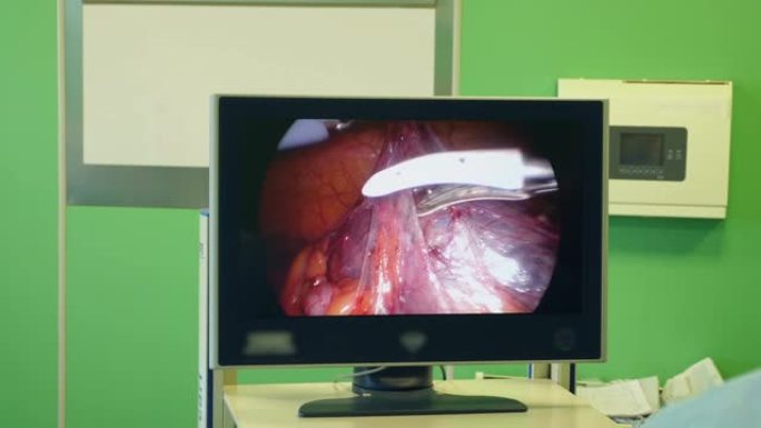 手术过程正在展示做手术动手术视频素材