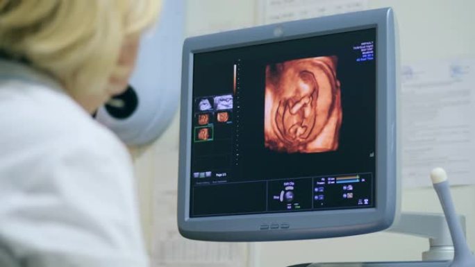 医生使用超声检查检查子宫中的婴儿。