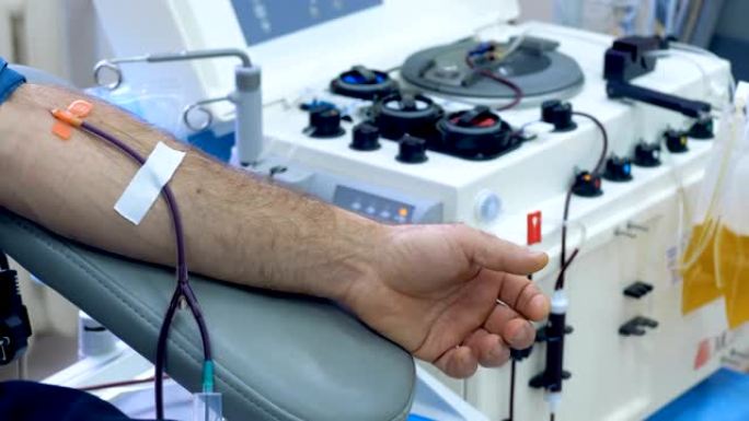 医疗机器正在从男性手上提取的血液中分离血浆