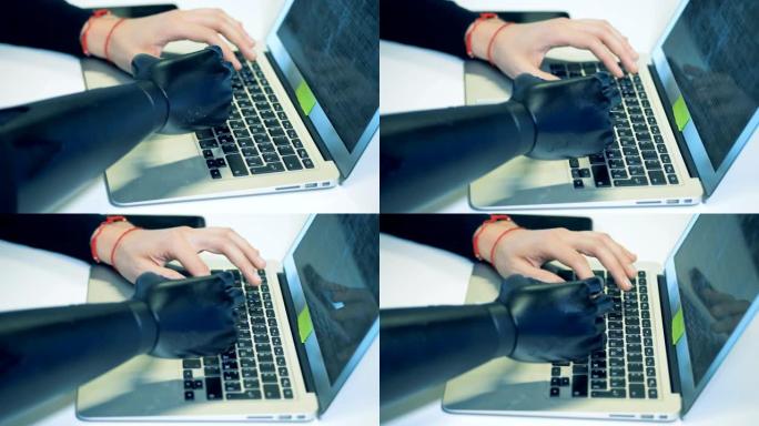 残疾人在笔记本电脑键盘上打字，写信。4K。