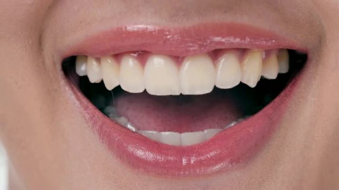 微笑女人的特写。牙科检查