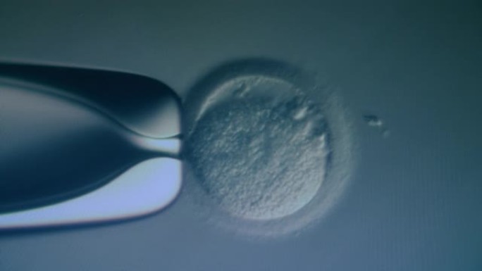 显微镜下的体外受精。