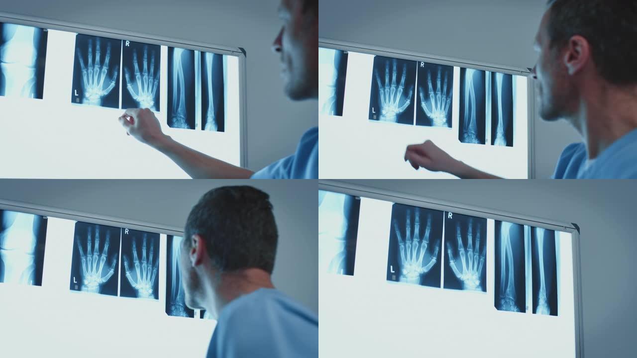 外科医生分析手指关节x线照片结果