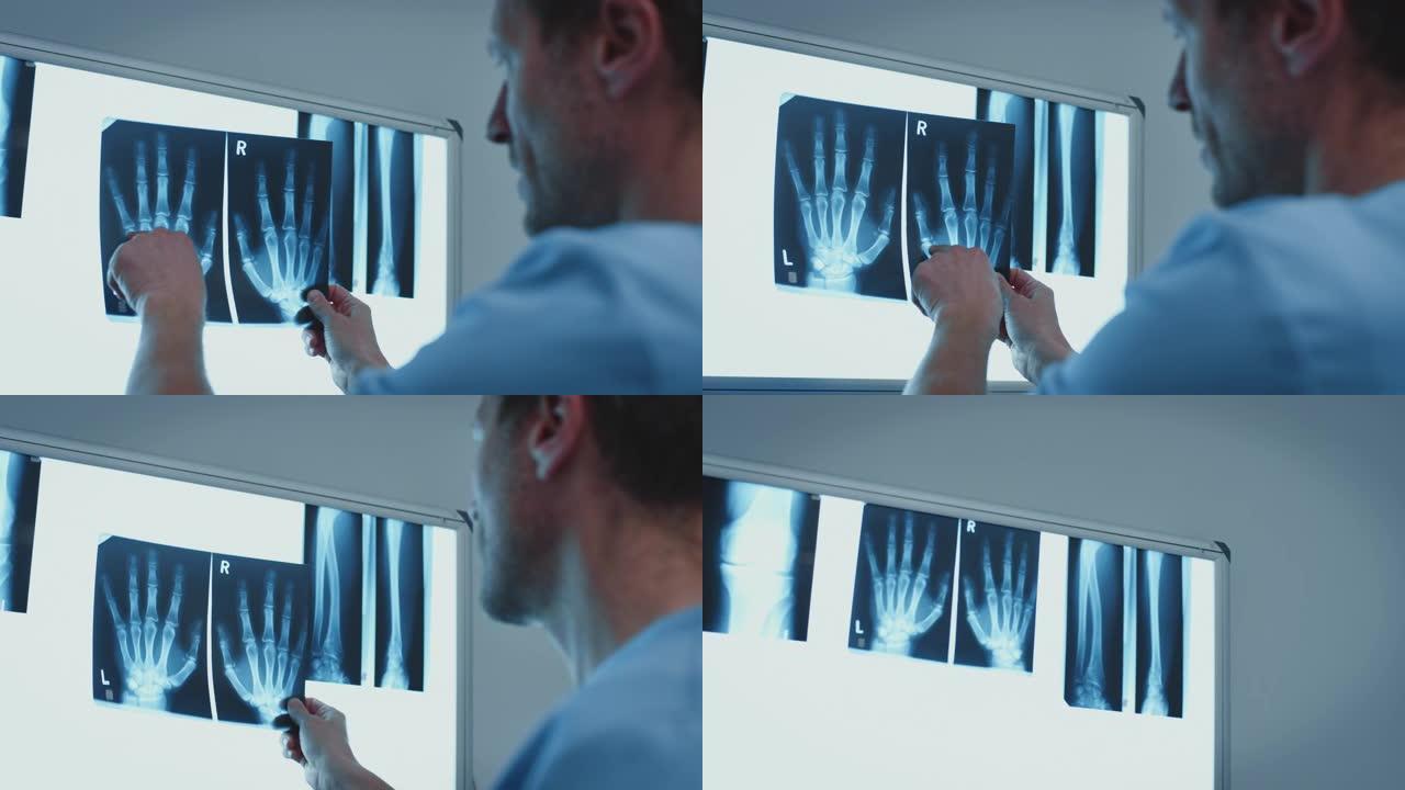 外科医生在医学x射线图像上指着手指