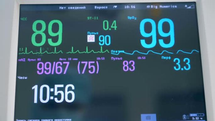 医疗监护仪上的生命体征测量值正在改变