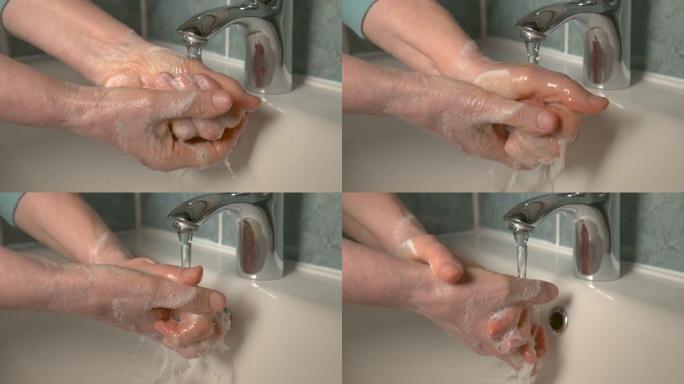 特写，dop: 面目全非的高级妇女用肥皂和水洗手。