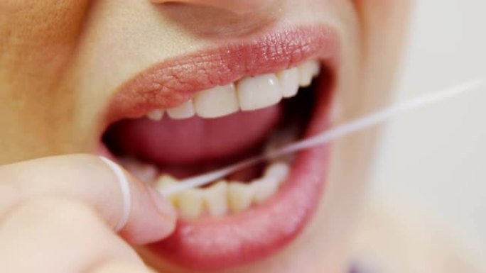 女性患者用牙线洁牙