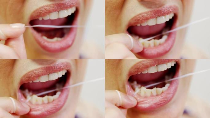 女性患者用牙线洁牙