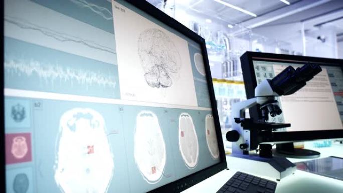 未来的实验室设备。计算机屏幕上的脑电波扫描研究