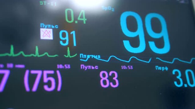 医疗屏幕上显示的脉搏和氧气速率显示的特写