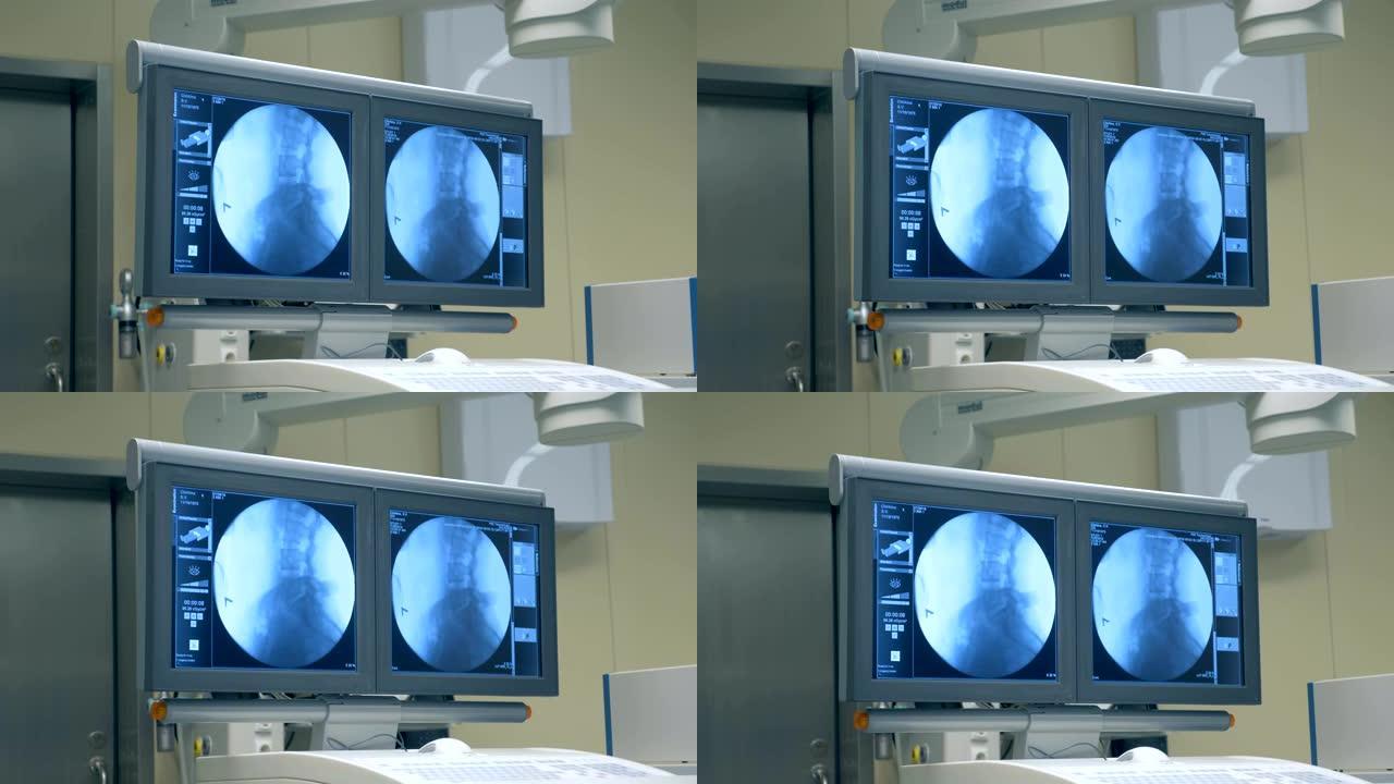 医学屏幕上脊柱和骨盆的图像。4K。