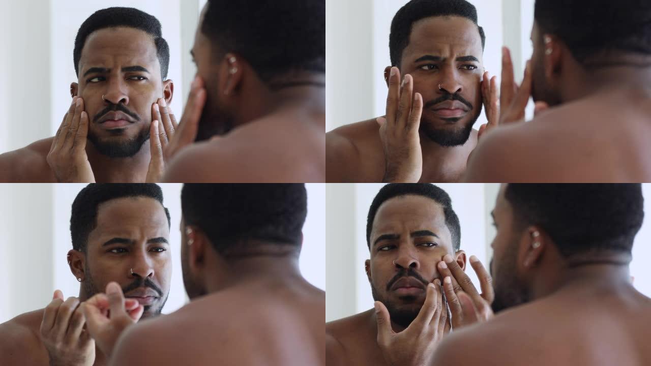 年轻的非洲男子照镜子有面部皮肤问题