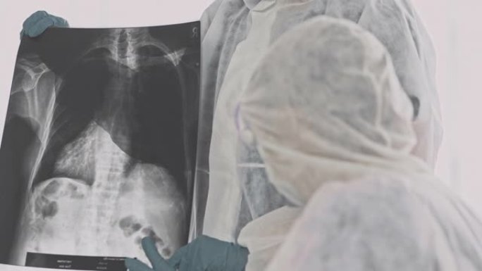 医生在看x光视频素材肺部CT查体