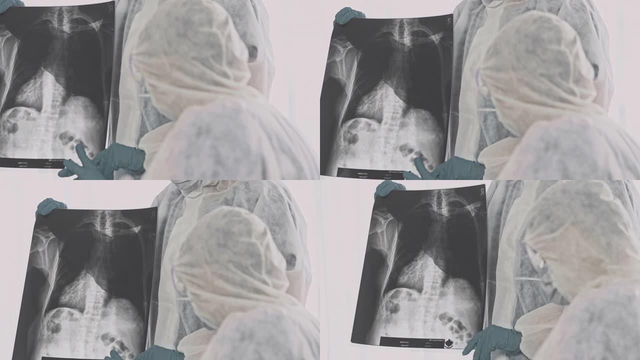 医生在看x光视频素材肺部CT查体