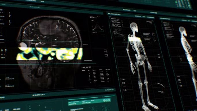 带有身体分析和dna在黑暗背景上移动的用户界面HUD动画，用于处理谷物的网络未来概念